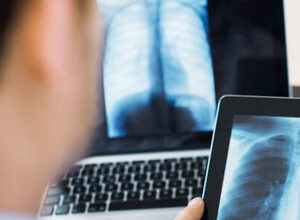 digital-x-ray